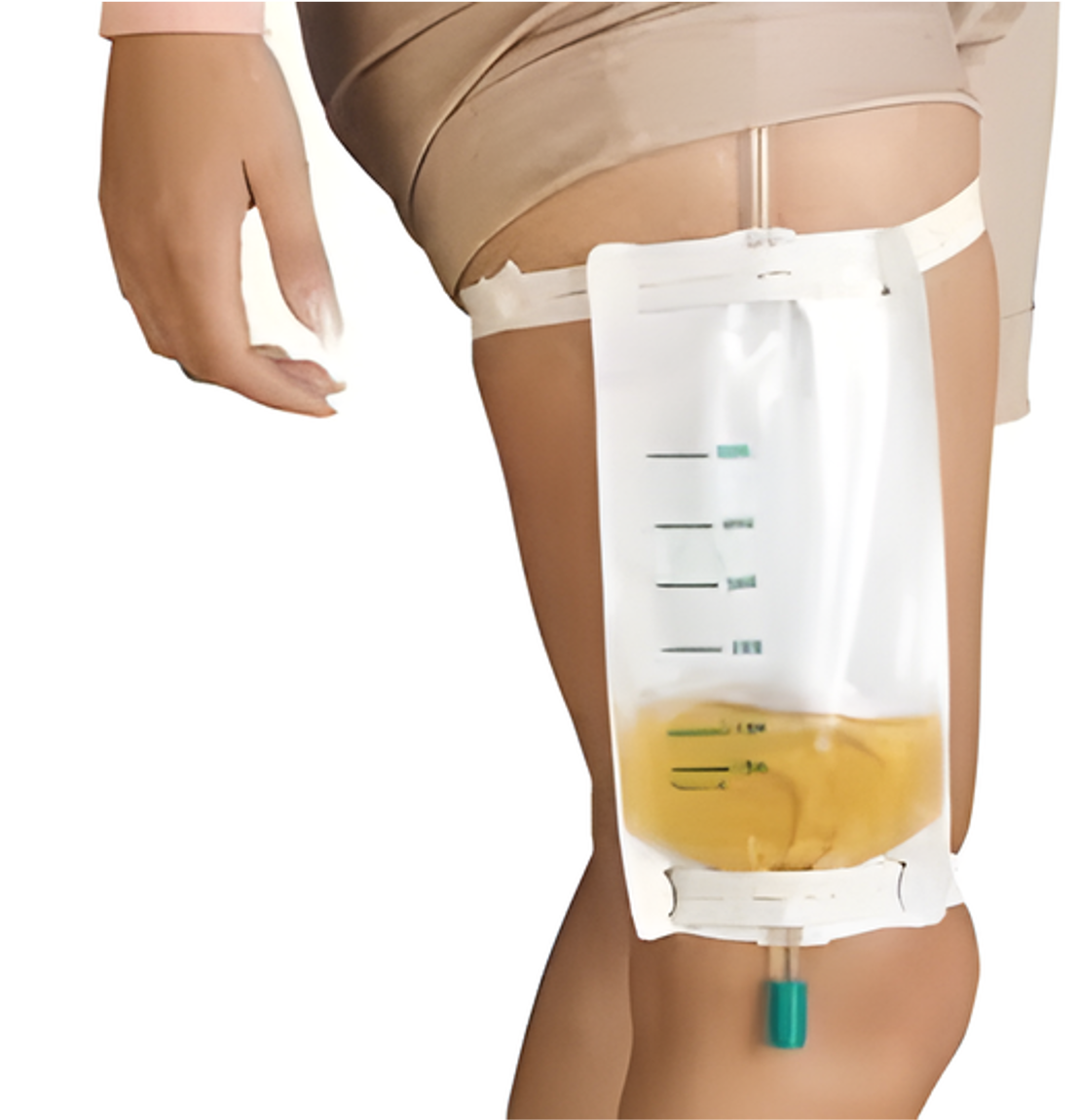 Conventional urine bag comparison